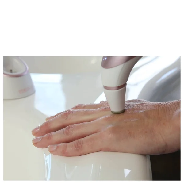 Homedics Radiance Microdermabrasion