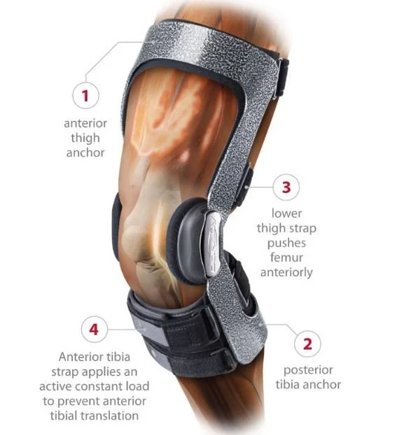 DonJoy 11-1443-2 Armor FP, ACL, STD, LT, S